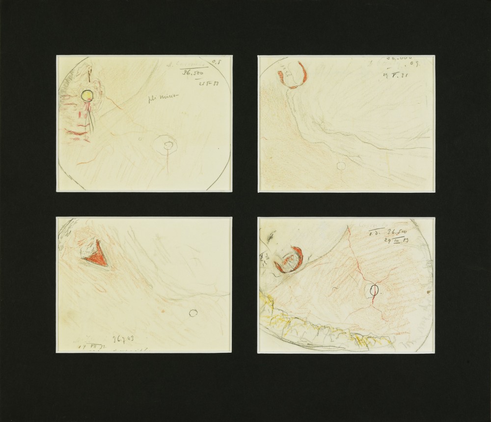 Dessins de la rétine