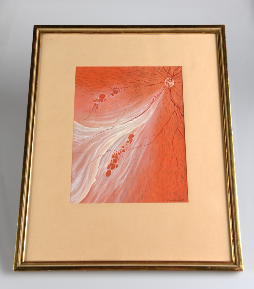 Dessin du fond d'œil 