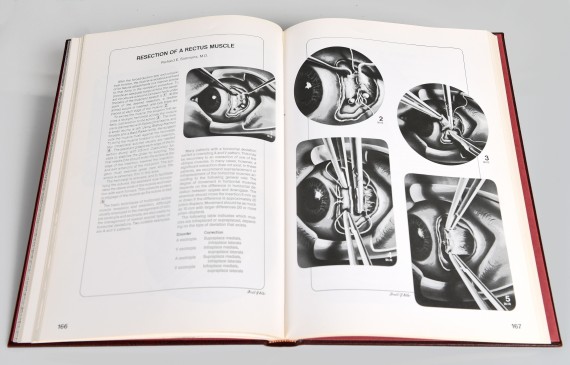 Atlas of Eye Surgery and related anatomy, Frederick H. Davidorf, Donald A. Keller