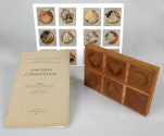 Thèse du Docteur Eugène Annen, Sarcomes choroïdiens avec 8 plaques de cuivre 